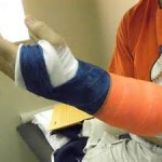 cast