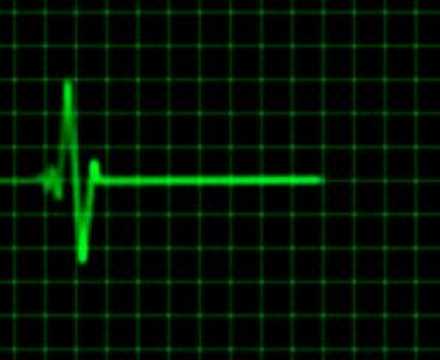 heart-rate